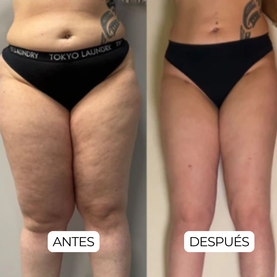 Resultado 3