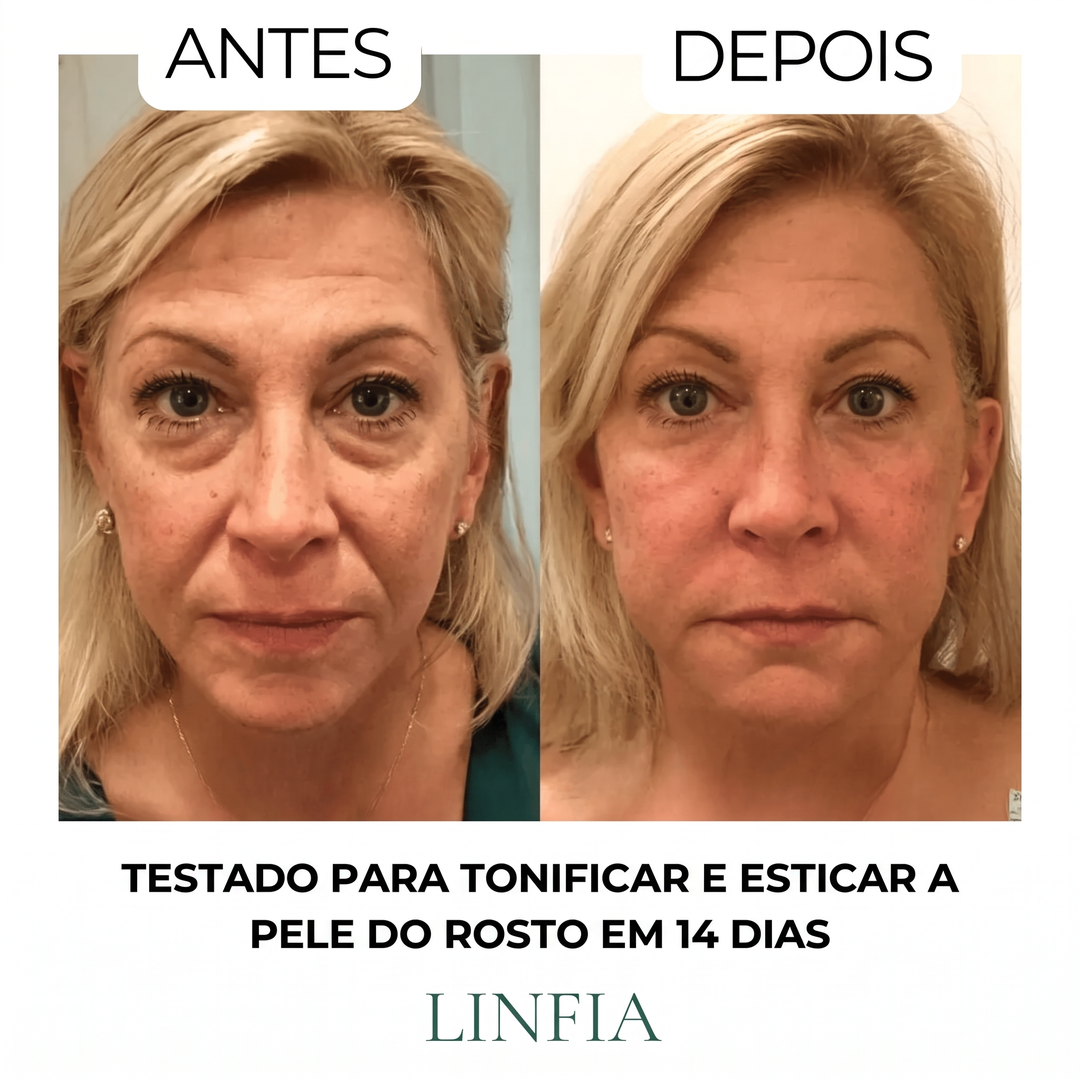 Escova para drenagem linfática LINFIA