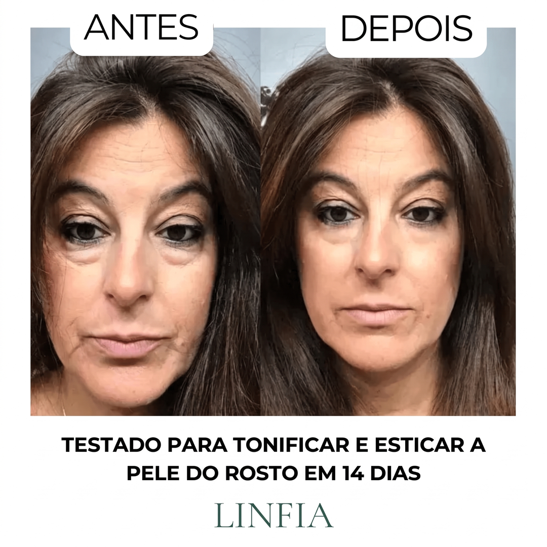 Escova para drenagem linfática LINFIA