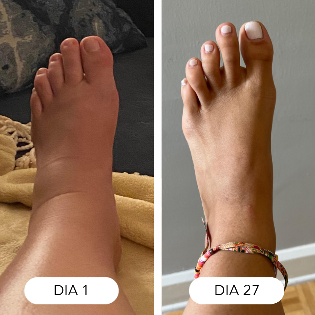 Gotas de drenagem linfática LINFIA