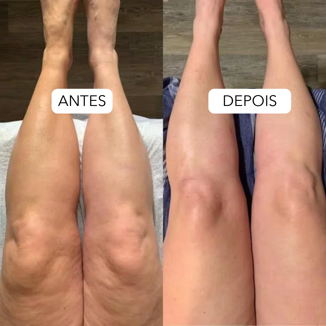 LINFIA Drenagem Linfática